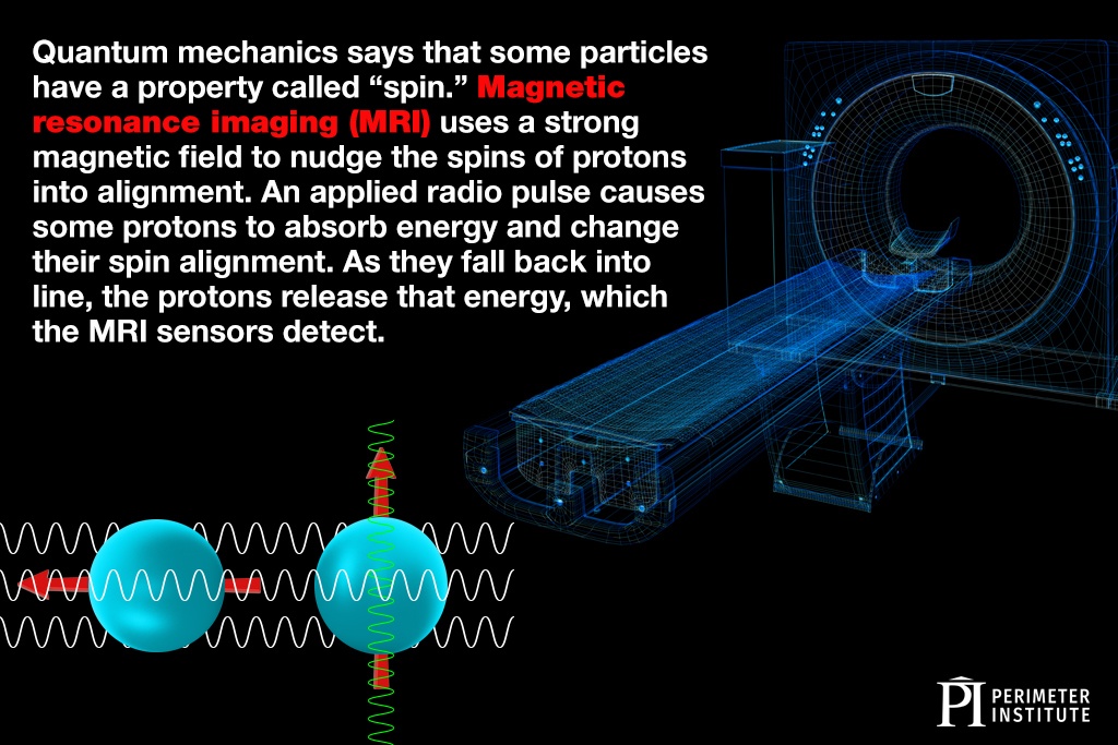 Selon la mécanique quantique, certaines particules ont une propriété appelée « spin ». L’imagerie par résonance magnétique (IRM) fait appel à un fort champ magnétique pour aligner le spin de protons. Une impulsion radio fait en sorte que certains protons absorbent de l’énergie, ce qui modifie l’alignement de leur spin. Quand ils se réalignent, ces protons libèrent cette énergie, qui est détectée par les capteurs de l’appareil d’IRM.